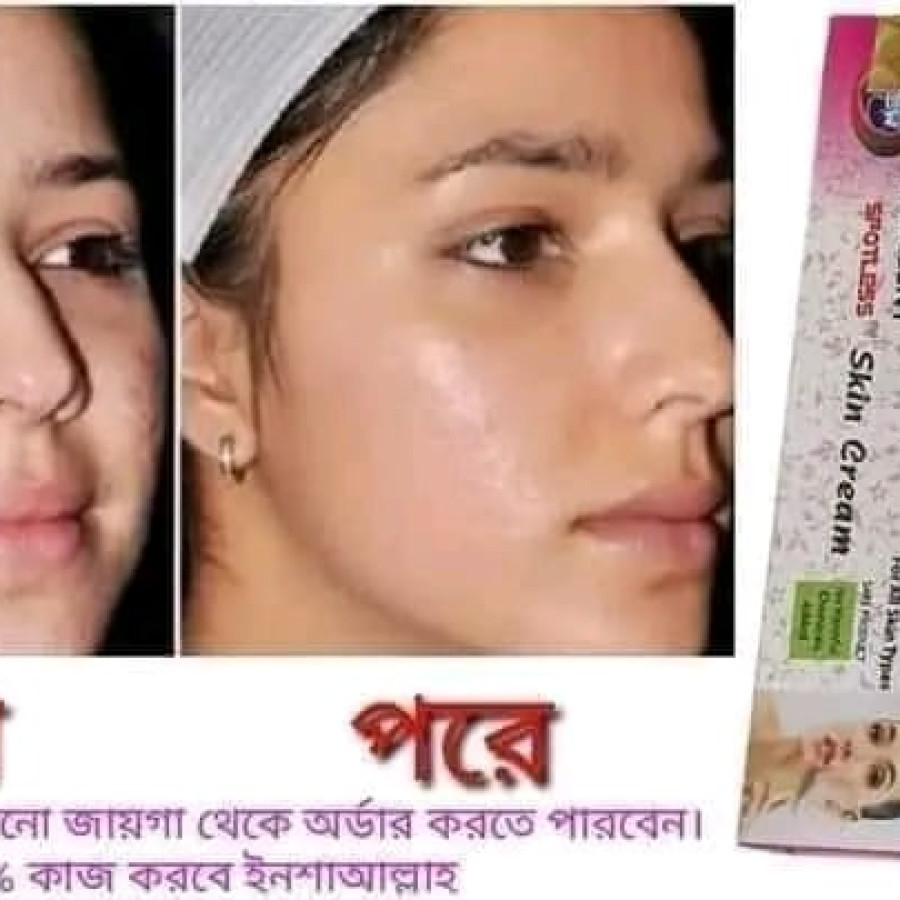 Excellent Spotless Skin Cream